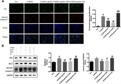 Acylated Ghrelin is Protective Against 6-OHDA-induced Neurotoxicity by Regulating Autophagic Flux